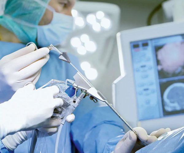 Neuroendoscopia